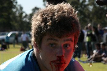 Cronulla Sharks forward with a bit of claret on his face (Photo : ourfooty media)